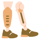 Artificial Limbs