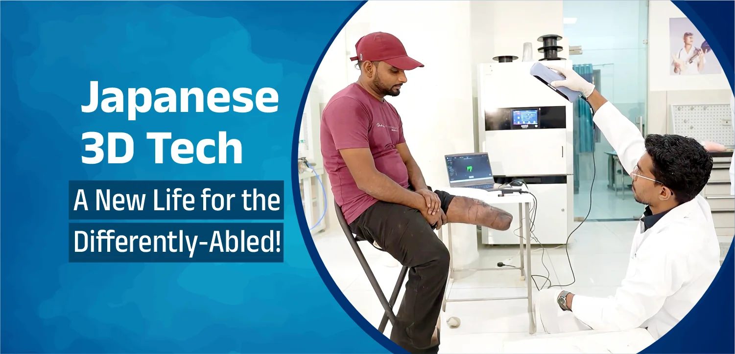 Japanese 3D Technology is Changing the Lives of Specially-Abled People with Free Artificial Limbs