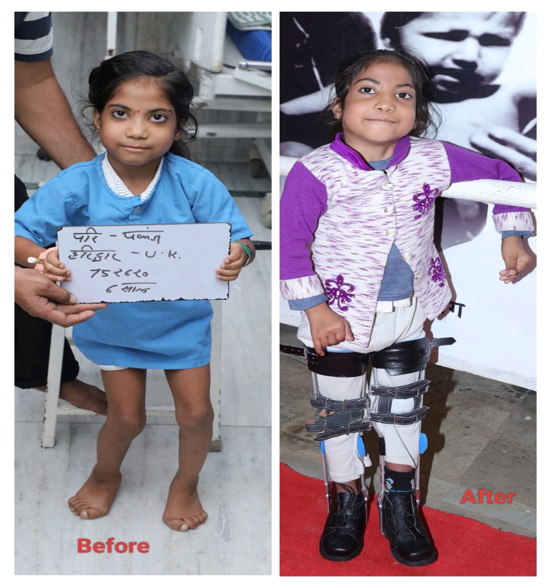 <h1>Surgery in Narayan Hospital</h1>