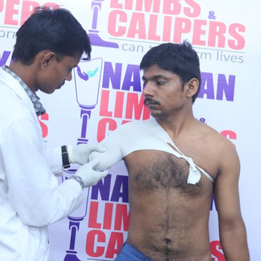 Artificial Limb Distribution Camp Visakhapatnam