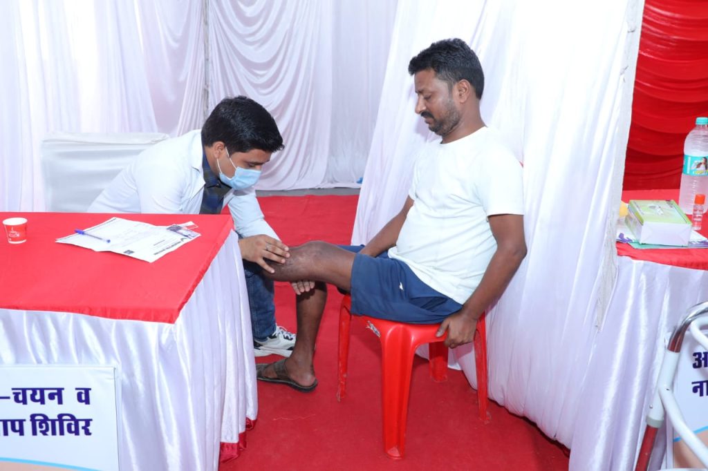 Narayan Seva Sansthan - Narayan Limb Distribution Camp Indore