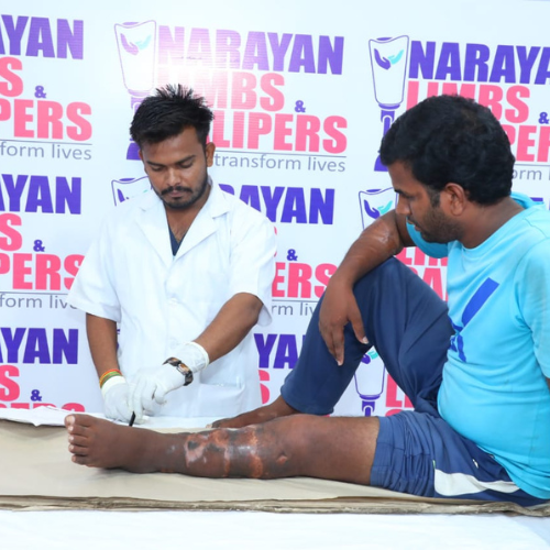 Narayan Limb Distribution Camp Lucknow 007