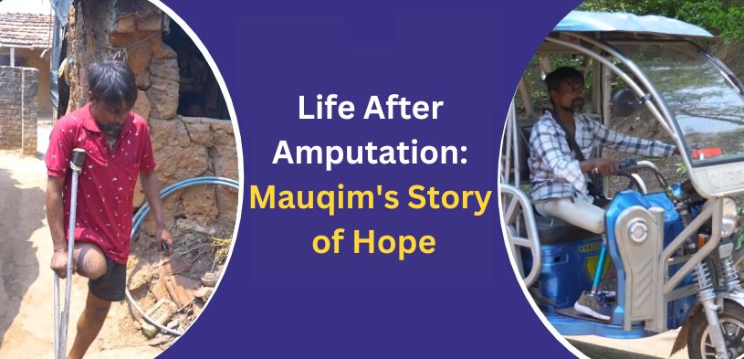 From Limb Loss to Life's Triumph Mauqim Sheikh's Inspiring Story of Resilience